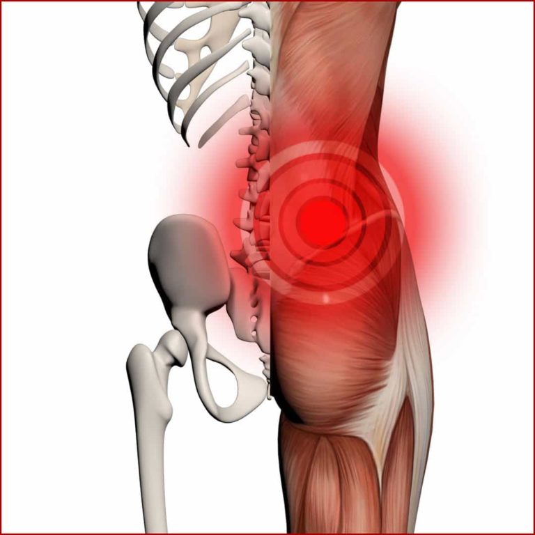 Sciatica 768x768